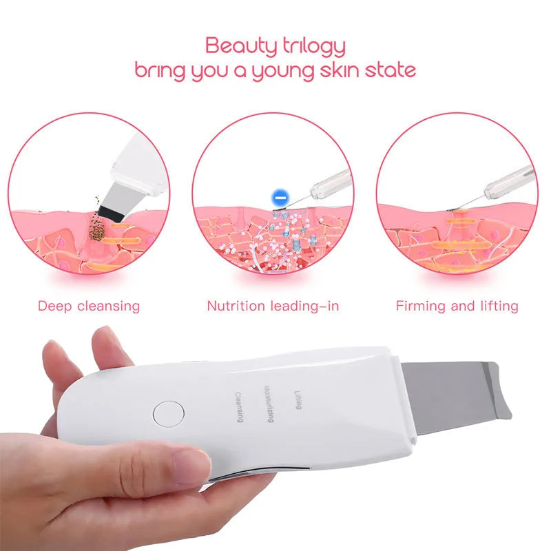 Ultrasonic Skin Scrubber Face Spatula Blackhead Remover