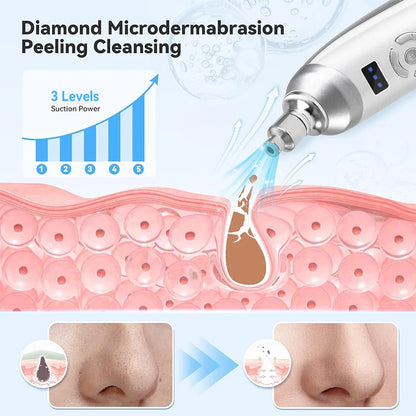 Handheld Diamond Microdermabrasion Machine